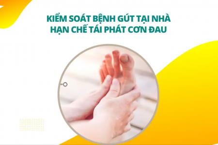 Cách kiểm soát bệnh gút tại nhà, hạn chế tái phát cơn đau