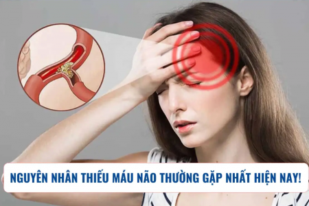 Các nguyên nhân thiếu máu não thường gặp nhất hiện nay
