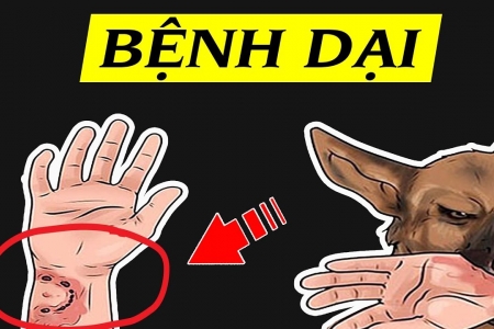 Hà Nội: Xuất hiện ổ dịch dại trên chó, cảnh báo mức độ nguy hiểm độ III từ các vết cắn