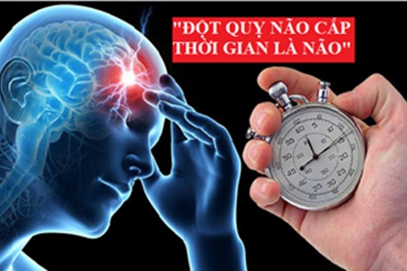 Tầm quan trọng của việc điều trị đột quỵ tại địa phương nhằm tận dụng "giờ vàng"