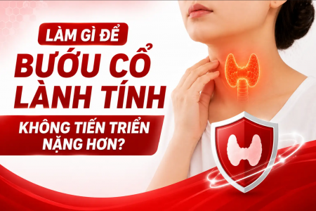 Làm gì để bướu cổ lành tính không tiến triển nặng hơn?
