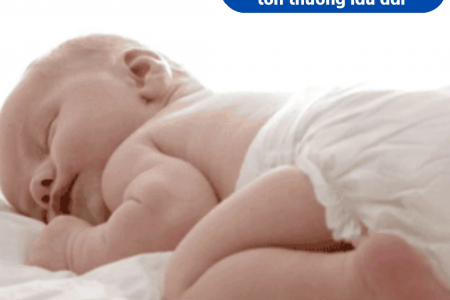 Hăm tã ở trẻ nhỏ: Chăm sóc sai cách, da bé dễ bị tổn thương lâu dài