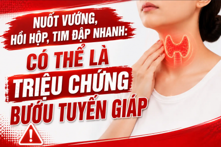 Nuốt vướng, tim đập nhanh: Chớ coi thường "tiếng kêu cứu" từ tuyến giáp