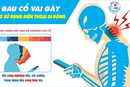 Cảnh báo các vấn đề xương khớp và thị lực do thói quen sử dụng điện thoại sai tư thế