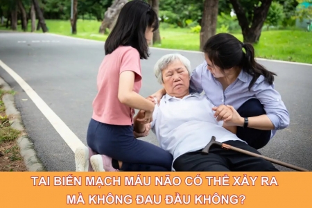 Tai biến mạch máu não có thể xảy ra mà không đau đầu không?