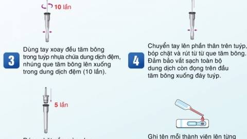 Đồng Tháp hướng dẫn công dân cách tự lấy mẫu xét nghiệm SARS-CoV-2