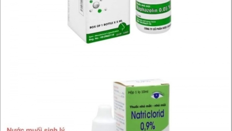 Bệnh viện Trẻ em Hải Phòng cảnh báo ngộ độc thuốc nhỏ mũi Naphazolin
