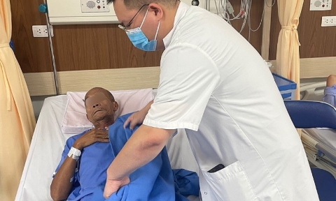 Cảnh báo có thể phải cắt bỏ chi do hút thuốc gây tắc động mạch cấp tính