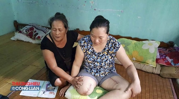 BV Đa khoa tỉnh Điện Biên: Cần làm rõ vụ “cưa chân” bất thường