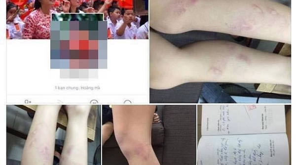 Hà Nội: Họp khẩn về việc 11 học sinh lớp 2 bị bạo hành