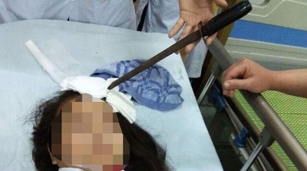 Hà Nam: Nữ sinh bị bạn học phi dao cắm thẳng trán
