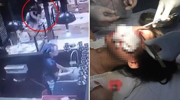Truy bắt đối tượng trêu ghẹo rồi hành hung phụ nữ tại Nam Định