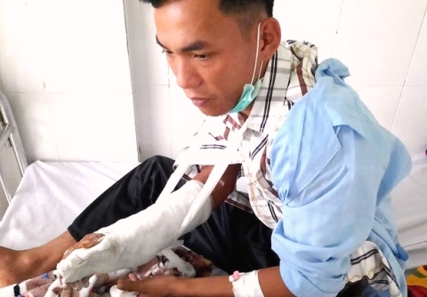 Kon Tum: Nhân viên bảo vệ rừng bị chém trọng thương vì không cho xe độ chế vào rừng