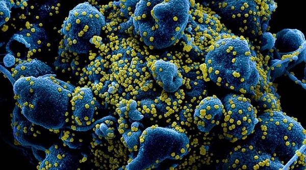 Sản xuất thành công kháng thể đơn dòng tiêu diệt được virus corona