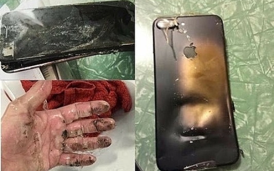 Hà Giang: Bé trai bị dập nát bàn tay do điện thoại phát nổ