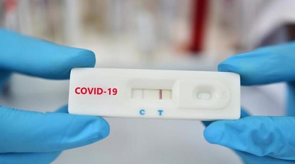 Bộ Y tế yêu cầu các cơ sở sản xuất, NK báo cáo giá bán test xét nghiệm Covid-19