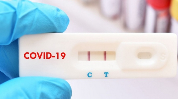 Đồng Nai: Yêu cầu các đơn vị không thu phí xét nghiệm test nhanh Covid-19 của bệnh nhân