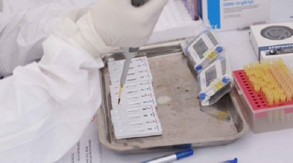 Công an quận Bắc Từ Liêm thu giữ gần 5.000 bộ sinh phẩm xét nghiệm SARS-CoV-2