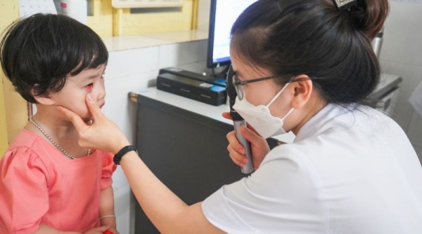 TP. Hồ Chí Minh: Coxsackievirus A24 là tác nhân chính gây bùng phát bệnh đau mắt đỏ