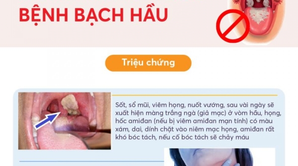 Công điện của Thủ tướng về tăng cường công tác phòng, chống bệnh bạch hầu