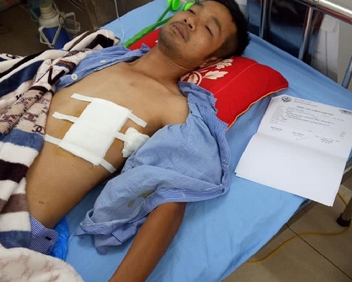 Bắc Giang: Nam thanh niên suýt mất mạng vì bị tấn công bằng súng, dao bầu? Bắc Giang: Nam thanh niên suýt mất mạng vì bị tấn công bằng súng, dao bầu?