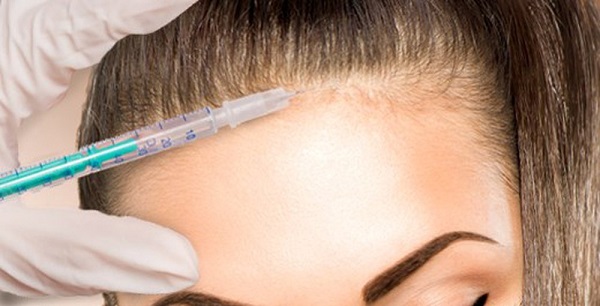 Thận trọng với trào lưu tiêm botox làm đẹp tóc Thận trọng với trào lưu tiêm botox làm đẹp tóc
