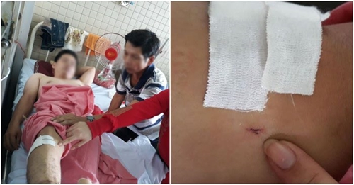 Vụ gãy đốt sống bị khoan nhầm cẳng chân: Đình chỉ công tác hai nhân viên y tế Vụ gãy đốt sống bị khoan nhầm cẳng chân: Đình chỉ công tác hai nhân viên y tế