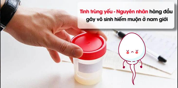 Tinh trùng yếu - Nguyên nhân gây vô sinh hiếm muộn ở nam giới