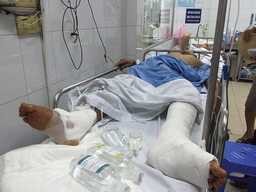 Tại Bệnh viện Việt Đức: Hội chẩn chân trái, mổ nhầm sang chân phải - Hình 1