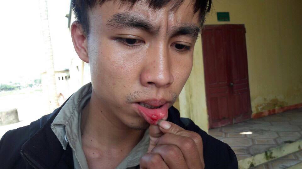 Hà Tĩnh: Công an xã bắt giữ, đánh đập người trái pháp luật