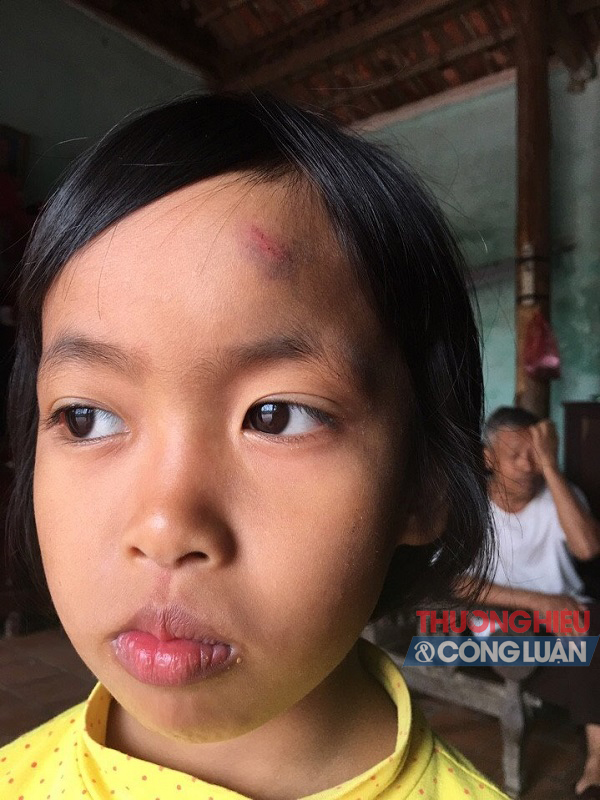 Trẻ lớp mầm non nói chuyện riêng bị giáo viên ném dép vào mặt?