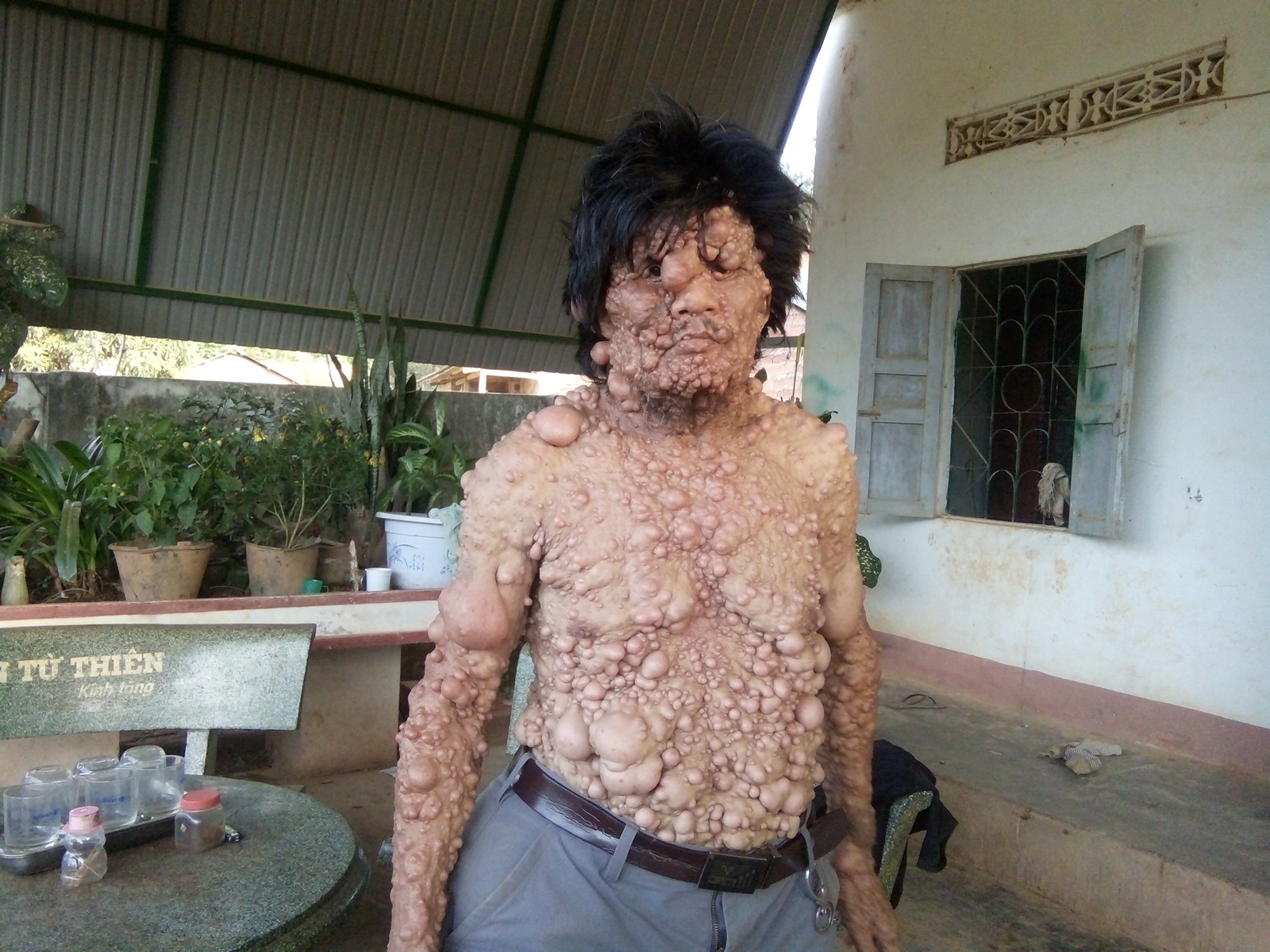 Đắk Lắk: Xót xa gia đình mang hình hài... “mặt quỷ”