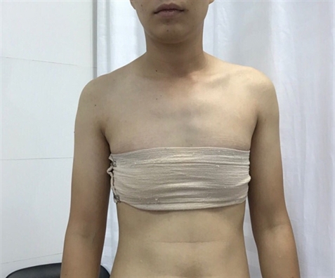 Việt Nam sắp thực hiện ca phẫu thuật chuyển giới - Hình 1