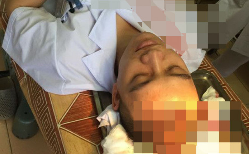 Bác sỹ bị đánh vỡ đầu, nghi chấn thương sọ não - Hình 1