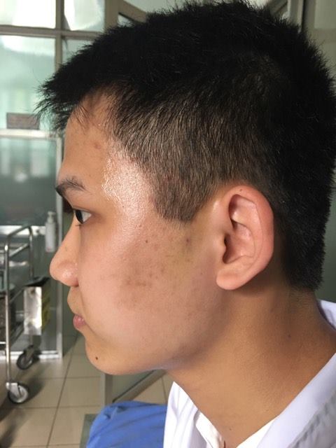 Thái Nguyên: Sinh viên trường y bị đánh, Bộ Y tế vào cuộc