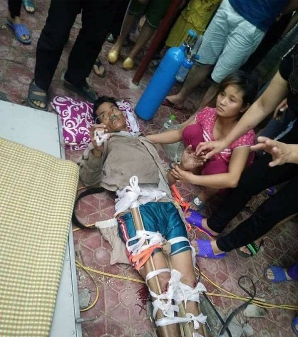 Hà Tĩnh: Rơi từ độ cao 6 m, người đàn ông bị gãy 2 chân - Hình 1