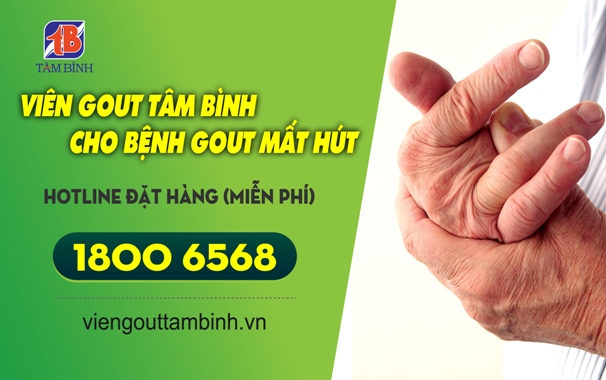 Mùa du lịch tiếp tay bùng phát nguy cơ Gout cấp
