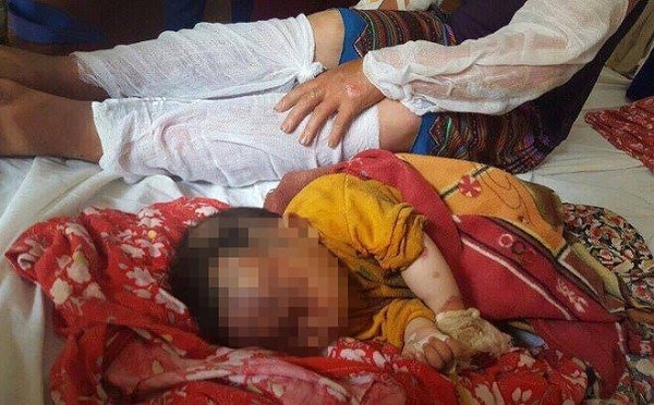 Lào Cai: Nổ khí gas ở huyện Bắc Hà 10 người bị bỏng nặng