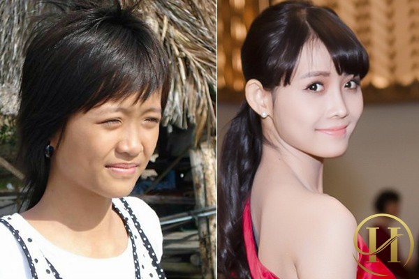 Trước khi phẫu thuật thẩm mỹ, dàn mỹ nhân The Face 2017 có gương mặt như thế này