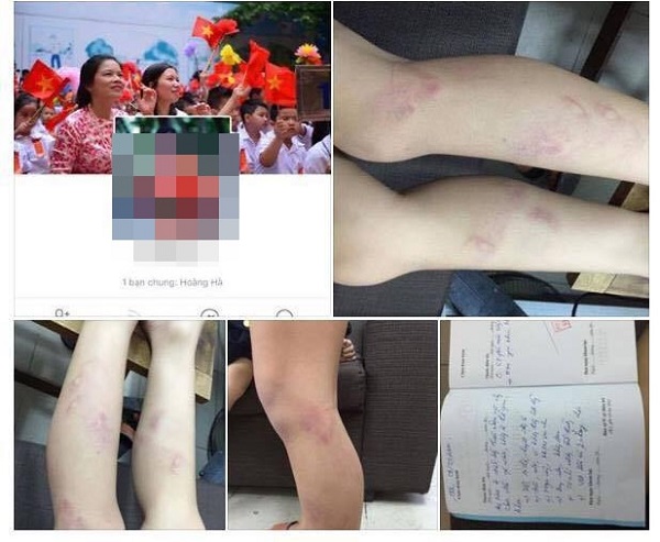 Hà Nội: Họp khẩn về việc 11 học sinh lớp 2 bị bạo hành - Hình 1