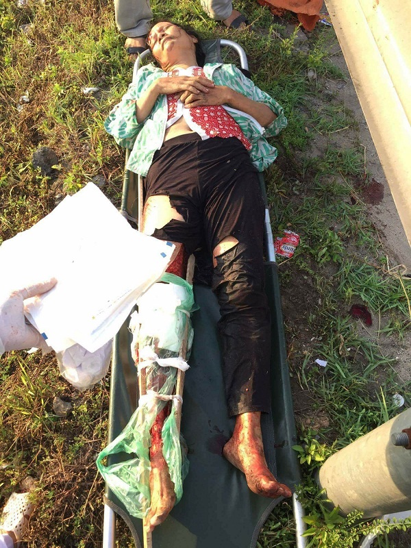 Hà Tĩnh: Bắt tài xế cán nát chân một phụ nữ, lái xe bỏ chạy ra Hải Phòng - Hình 1