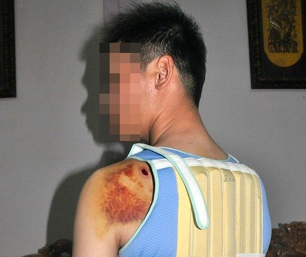 Đắk Nông: Khởi tố con trai bí thư đảng ủy xã dùng súng điện bắn người - Hình 1