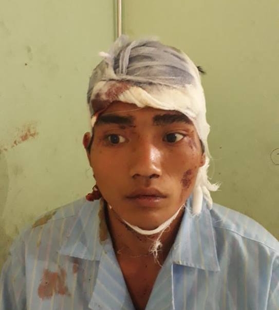 Nghệ An: Khởi tố người cha sát hại con gái, chém vợ trọng thương