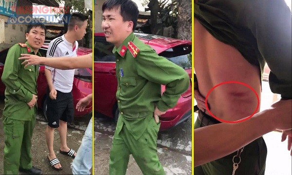 Giải quyết va chạm giao thông, cán bộ công an phường bị xe tải đâm bị thương