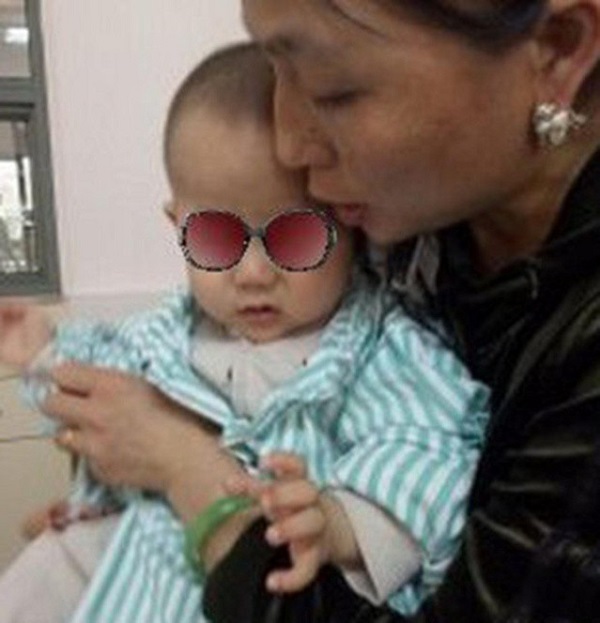 Em bé 3 chân ra đời ở Trung Quốc - Hình 2