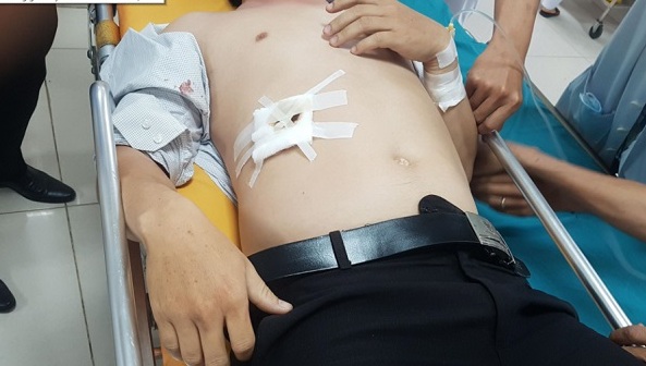 Đâm trọng thương thầy giáo vì bị nhắc nhở hình xăm trên cổ