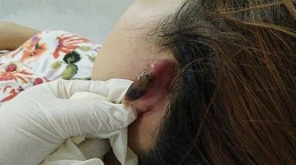 Bình Phước: Không trả nợ, cô gái bị chích điện, cắt tai - Hình 1