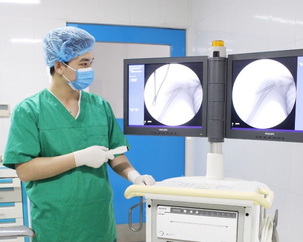 Bệnh viện Hữu nghị Lạc Việt đầu tư hệ thống “Cánh tay phẫu thuật”