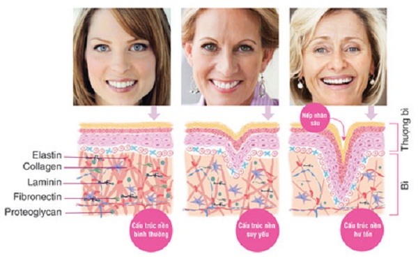 Ánh nắng mặt trời – “kẻ hủy diệt” làn da phái đẹp