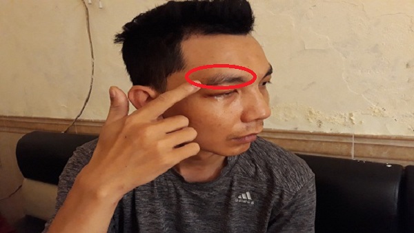 Cán bộ Công an phường Yên Hòa(Hà Nội) bị tố đánh người tại trụ sở?